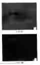 Fig. 10 - Soft tissue and bone augmentation and bulking utilizing muscle-derived progenitor cells, compositions and treatments thereof