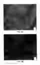 Fig. 11 - Soft tissue and bone augmentation and bulking utilizing muscle-derived progenitor cells, compositions and treatments thereof