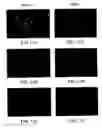 Fig. 13 - Soft tissue and bone augmentation and bulking utilizing muscle-derived progenitor cells, compositions and treatments thereof