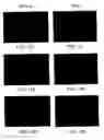 Fig. 14 - Soft tissue and bone augmentation and bulking utilizing muscle-derived progenitor cells, compositions and treatments thereof
