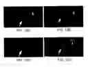 Fig. 15 - Soft tissue and bone augmentation and bulking utilizing muscle-derived progenitor cells, compositions and treatments thereof