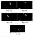 Fig. 16 - Soft tissue and bone augmentation and bulking utilizing muscle-derived progenitor cells, compositions and treatments thereof