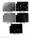 Fig. 17 - Soft tissue and bone augmentation and bulking utilizing muscle-derived progenitor cells, compositions and treatments thereof