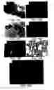 Fig. 19 - Soft tissue and bone augmentation and bulking utilizing muscle-derived progenitor cells, compositions and treatments thereof