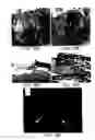 Fig. 20 - Soft tissue and bone augmentation and bulking utilizing muscle-derived progenitor cells, compositions and treatments thereof