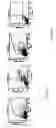 Fig. 14 - INDUCTION OF APOPTOSIS OF MALIGNANT CELLS BY ACTIVATION OF CALCIUM-ACTIVATED POTASSIUM CHANNELS
