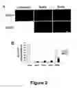 Fig. 03 - Methods for treating demyelination disorders