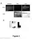 Fig. 04 - Methods for treating demyelination disorders
