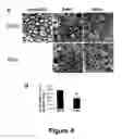 Fig. 05 - Methods for treating demyelination disorders