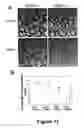 Fig. 12 - Methods for treating demyelination disorders