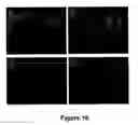 Fig. 17 - Methods for treating demyelination disorders