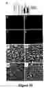 Fig. 21 - Methods for treating demyelination disorders