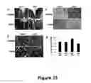 Fig. 24 - Methods for treating demyelination disorders