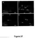 Fig. 28 - Methods for treating demyelination disorders