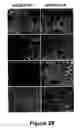 Fig. 29 - Methods for treating demyelination disorders