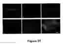 Fig. 32 - Methods for treating demyelination disorders