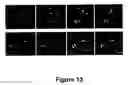 Fig. 34 - Methods for treating demyelination disorders