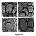 Fig. 38 - Methods for treating demyelination disorders