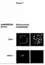 Fig. 08 - Modulation of NKG2D for treating or preventing solid organ allograft rejection
