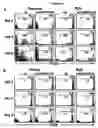 Fig. 10 - Modulation of NKG2D for treating or preventing solid organ allograft rejection