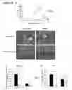 Fig. 21 - Modulation of NKG2D for treating or preventing solid organ allograft rejection