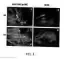 Fig. 05 - Flavivirus vaccine delivery system