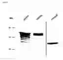 Fig. 05 - Live and subunit vaccines