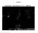 Fig. 06 - Nanofluidized B-12 composition and process for treating pernicious anemia