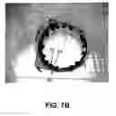 Fig. 07 - Coating for implantable devices and a method of forming the same