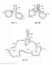 Fig. 02 - METHODS AND DEVICES FOR MAINTAINING SURGICALLY CREATED CHANNELS IN A BODY ORGAN