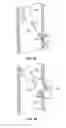 Fig. 04 - METHODS AND DEVICES FOR MAINTAINING SURGICALLY CREATED CHANNELS IN A BODY ORGAN