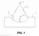 Fig. 02 - Method for use in orthodontics for treating patients with malocclusion