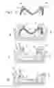 Fig. 02 - Method for producing a dental prosthesis and artificial tooth therefor
