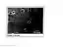 Fig. 15 - Cytological methods for detecting a disease condition such as malignancy by Raman spectroscopic imaging