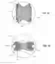 Fig. 12 - Ion channel assay methods