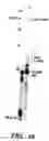 Fig. 11 - Method of performing reverse transcription reaction using reverse transcriptase encoded by non-LTR retrotransposable element