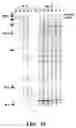 Fig. 19 - Method of performing reverse transcription reaction using reverse transcriptase encoded by non-LTR retrotransposable element