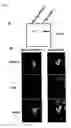 Fig. 07 - Method of diagnosing colon and gastric cancers