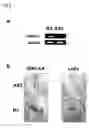 Fig. 08 - Method of diagnosing colon and gastric cancers