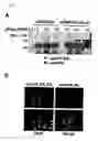 Fig. 11 - Method of diagnosing colon and gastric cancers