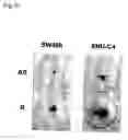 Fig. 13 - Method of diagnosing colon and gastric cancers