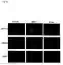 Fig. 15 - Method of diagnosing colon and gastric cancers