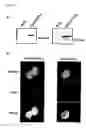 Fig. 20 - Method of diagnosing colon and gastric cancers