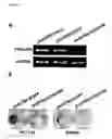 Fig. 22 - Method of diagnosing colon and gastric cancers