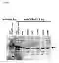 Fig. 28 - Method of diagnosing colon and gastric cancers