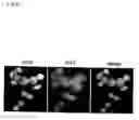 Fig. 29 - Method of diagnosing colon and gastric cancers