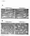 Fig. 30 - Method of diagnosing colon and gastric cancers