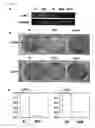 Fig. 34 - Method of diagnosing colon and gastric cancers