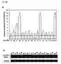 Fig. 37 - Method of diagnosing colon and gastric cancers