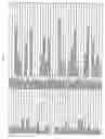 Fig. 04 - Identification of genes involved in angiogenesis, and development of an angiogenesis diagnostic chip to identify patients with impaired angiogenesis
